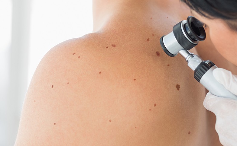 Skin-Cancer-Checks-and-Treatment